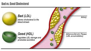 LDL cholesterol and heart disease