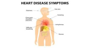 heart disease symptoms - chart pointing out various signs