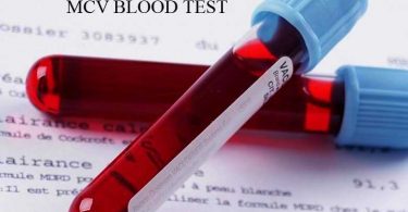 MCV Blood Test For Anemia