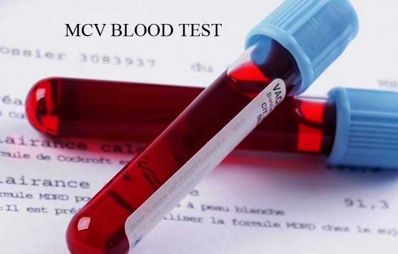mpv in blood test mpv in blood test